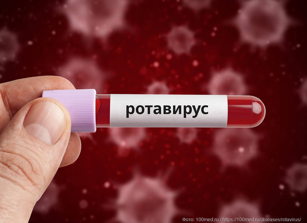 Нежданный спутник отпуска: как не подхватить ротавирус на отдыхе